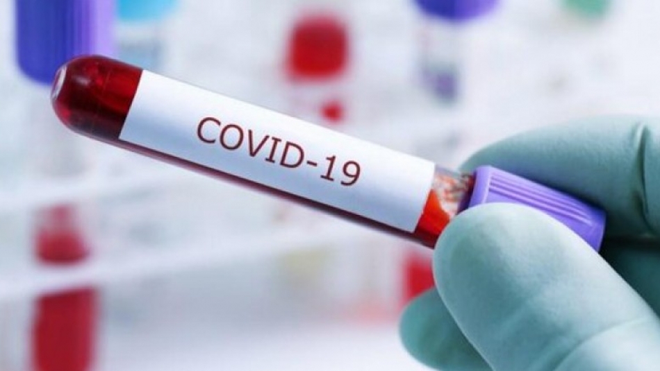 کانادا انجام اولین آزمایشات بالینی واکسن «کووید-۱۹» را تایید کرد